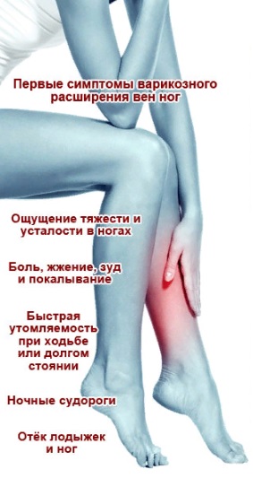 Первые симптомы заболевания вен на ногах