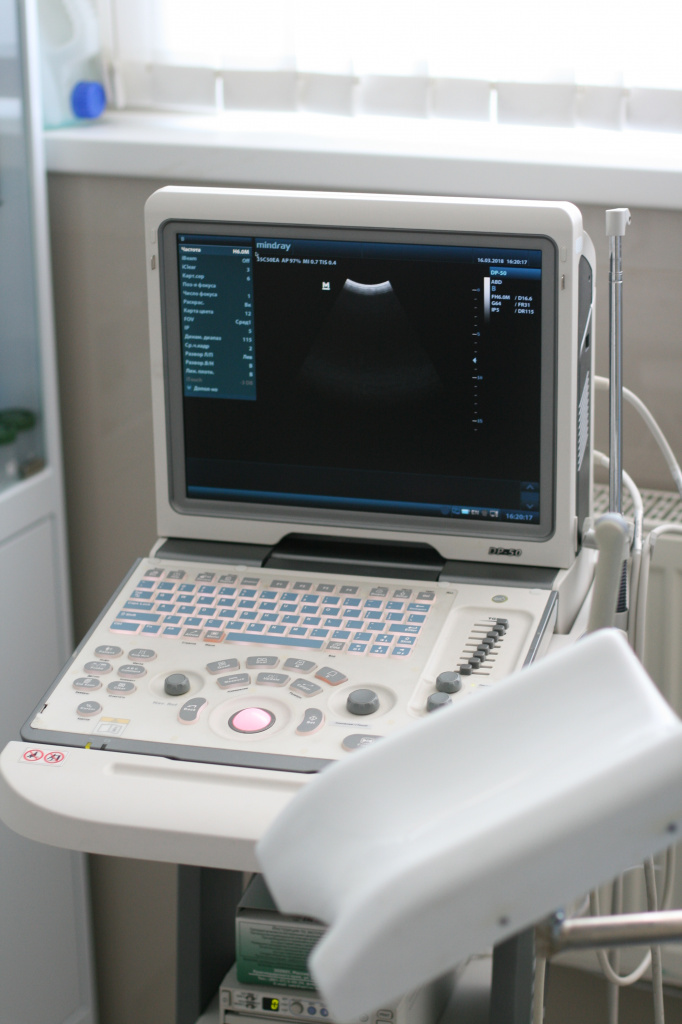 аппарат ультразвуковой диагностики в отделении гинекологии